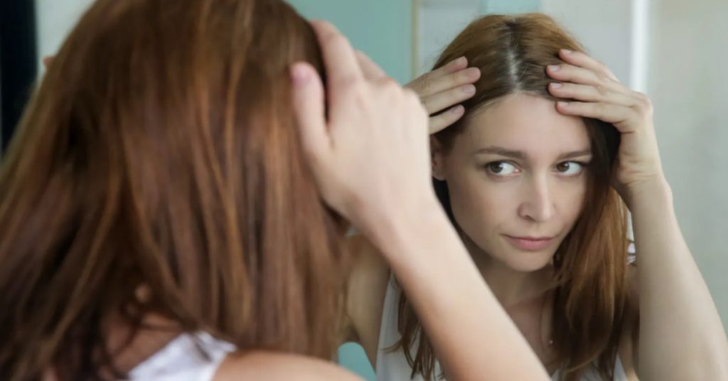 Bệnh nấm da đầu nên hạn chế sử dụng thuốc nhuộm, nếu nhuộm hãy nên nhuộm thuốc không tẩy để giúp tóc chắc khỏe